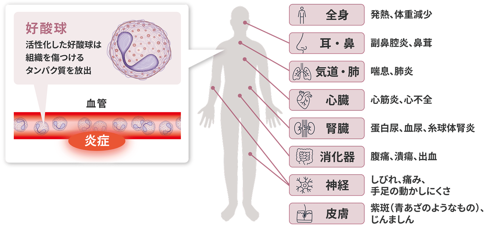 イメージ画像 全身に起こりうるさまざまな症状